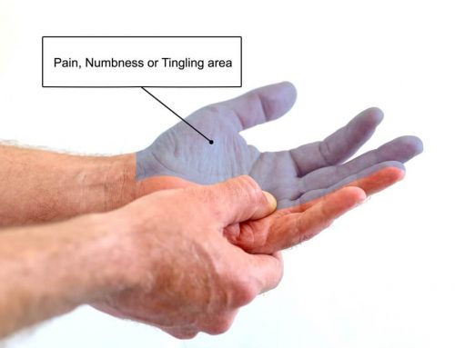 Pain Management Game-Changer: Peripheral Nerve Stimulation